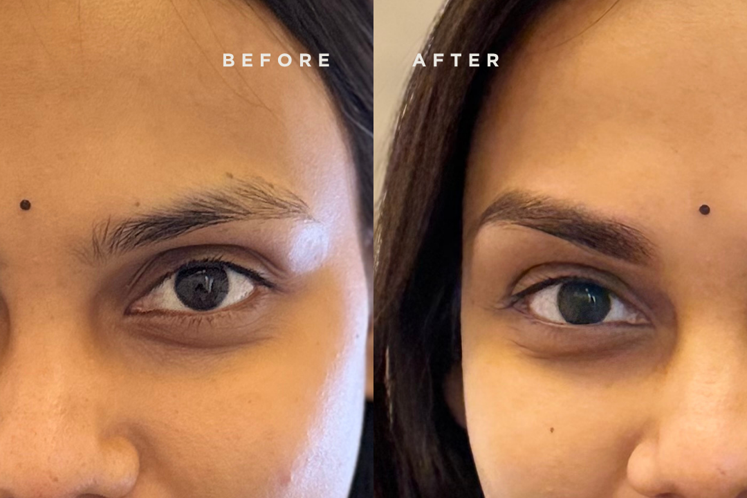 BELKESE Brow & Lips Studio Chennai